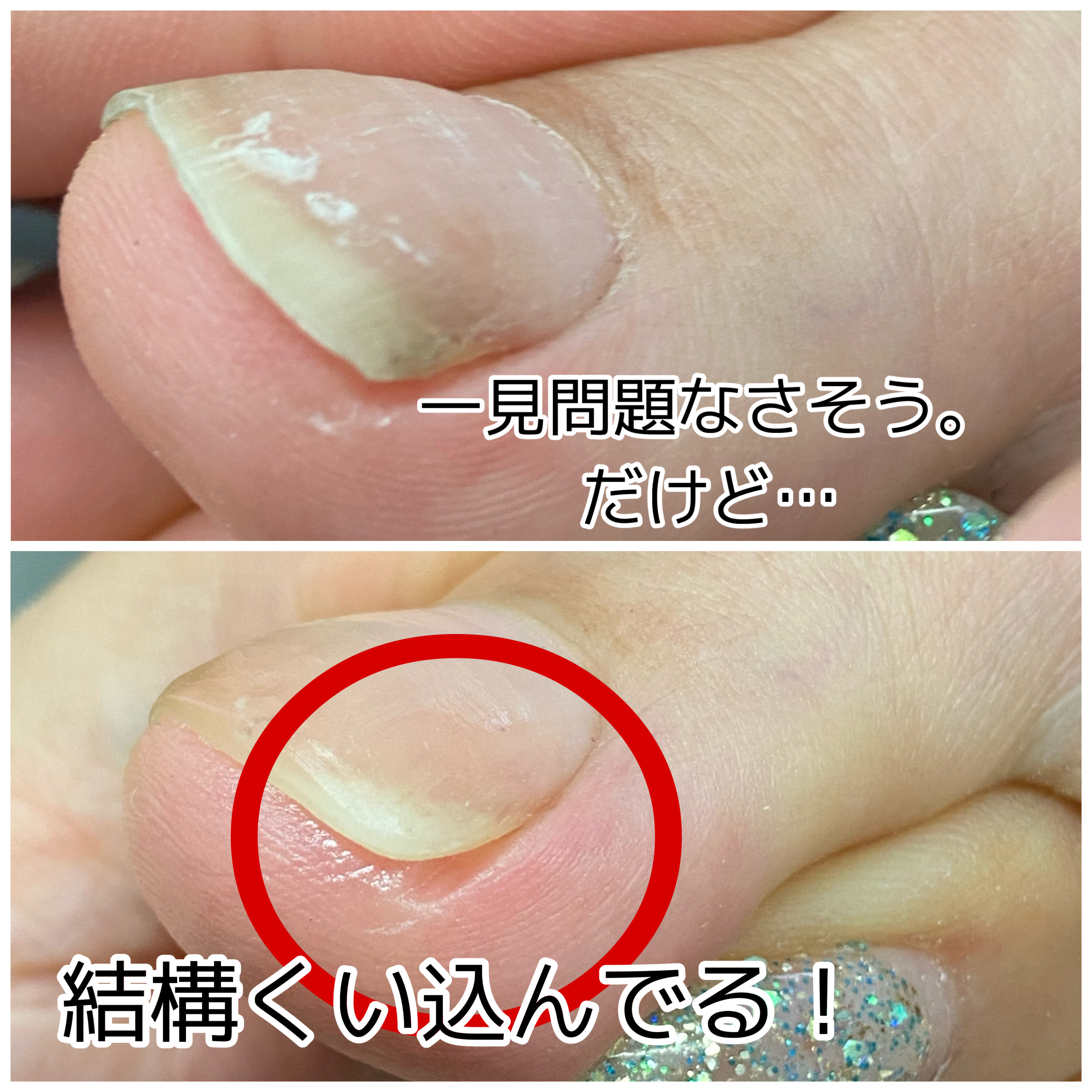 ダウンロード