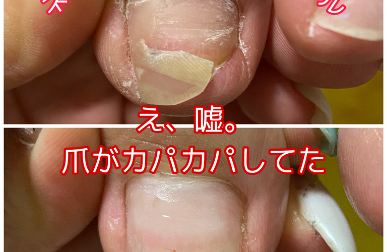 フットジェルしたままは危険